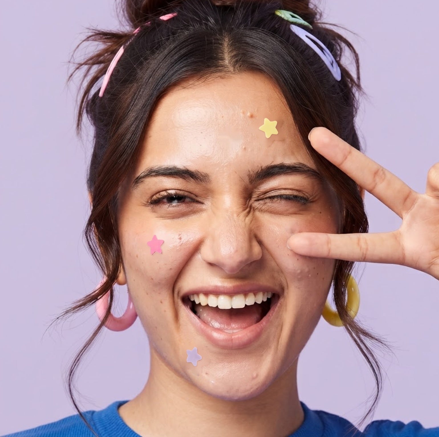 Get the Zit Out - Stars