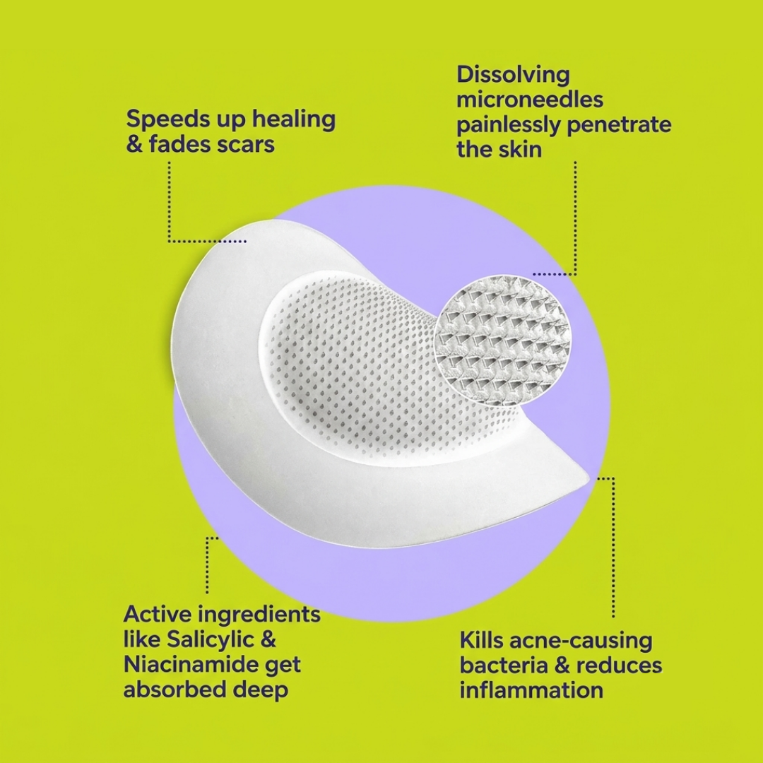 Get the Zit Out - Microneedle